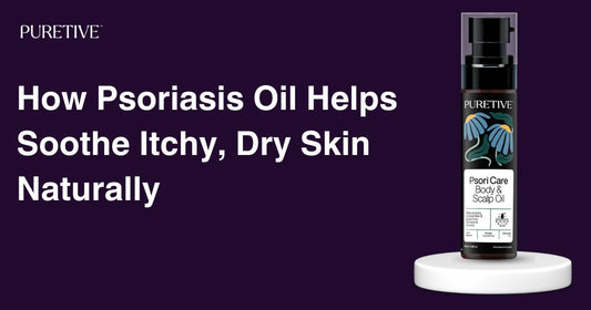 How Psoriasis Oil Helps Soothe Itchy, Dry Skin Naturally