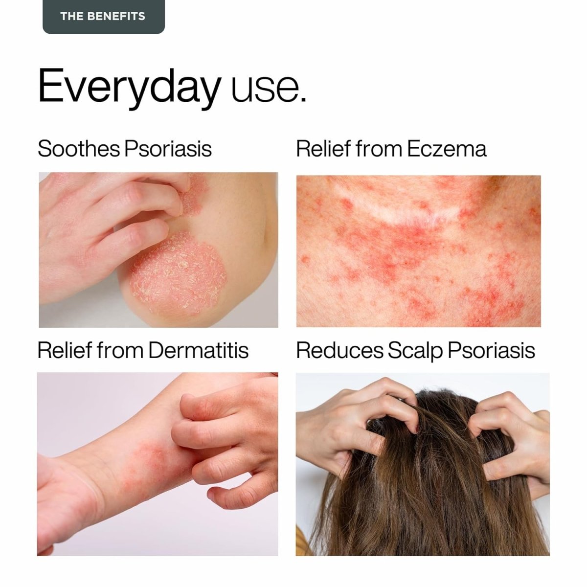 Psori Care Body Scalp Oil - Puretive Botanics