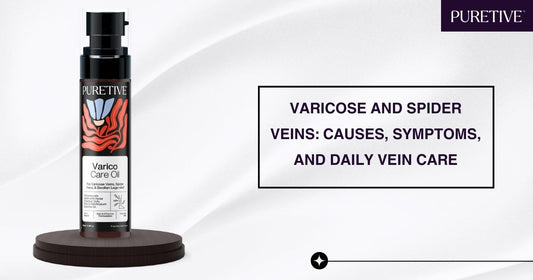 Understanding Varicose and Spider Veins: Causes, Symptoms, and Daily Support