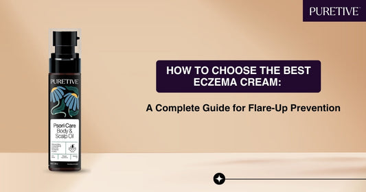 Eczema Cream