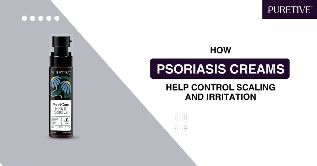 Best Psoriasis Treatment Cream – Reduce Itching And Scaling