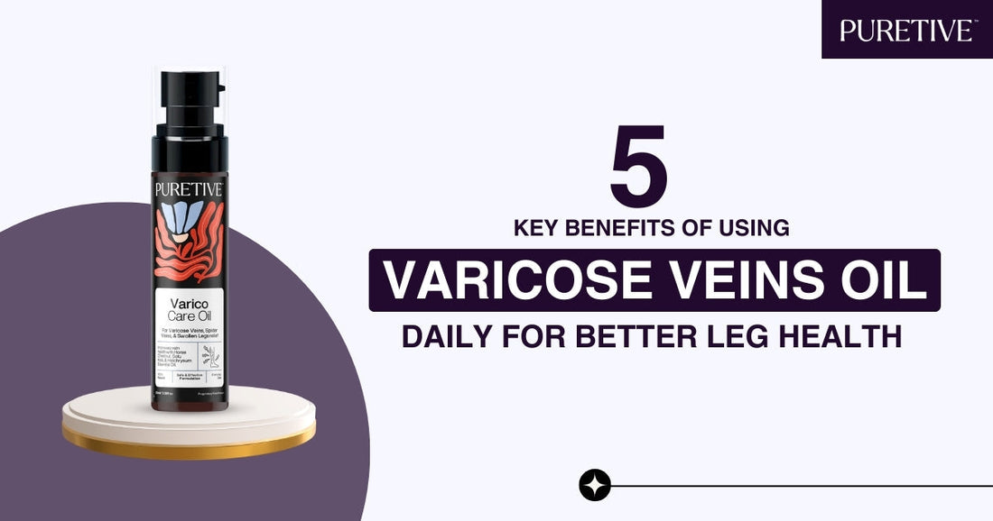 Top 5 Benefits of Using Varicose Veins Oil Daily for Leg Health