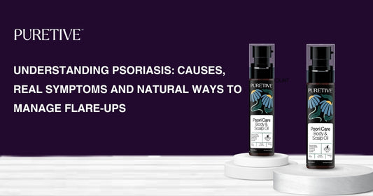 Understanding Psoriasis: Causes, Real Symptoms and Natural Ways to Manage Flare‑Ups