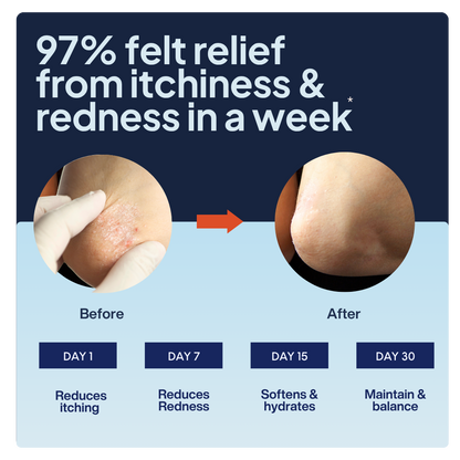 Psori Ease Body & Scalp Oil