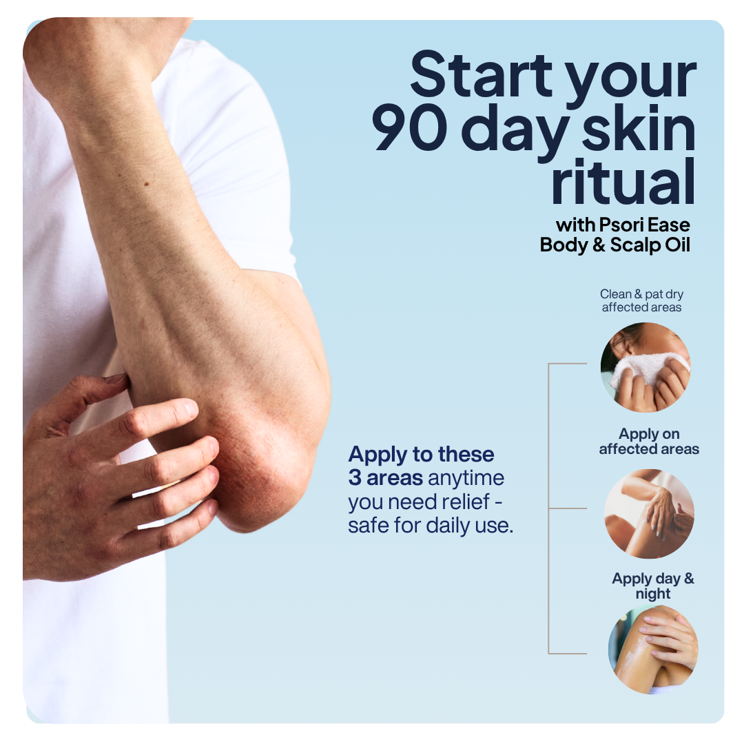 Psori Ease Body & Scalp Oil