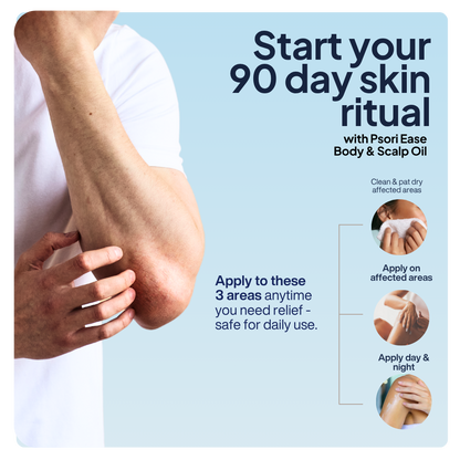 Psori Ease Body & Scalp Oil