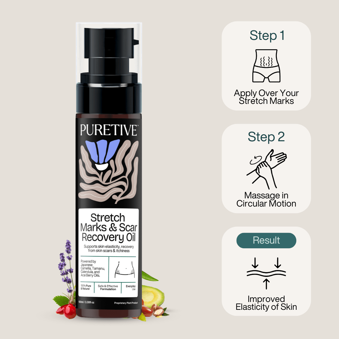 Stretch Marks & Scar Recovery Oil - Puretive Botanics